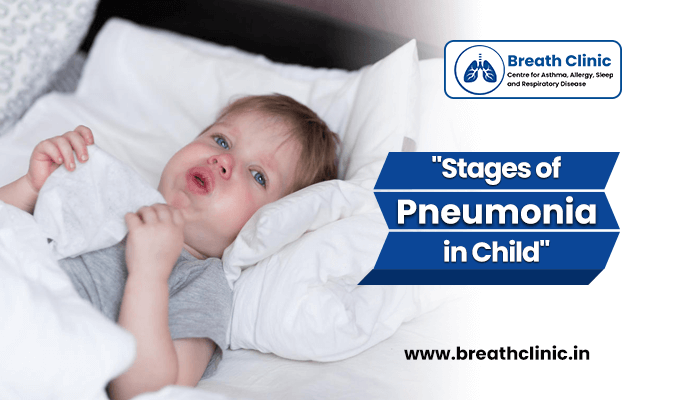 Stages of pneumonia in a child!