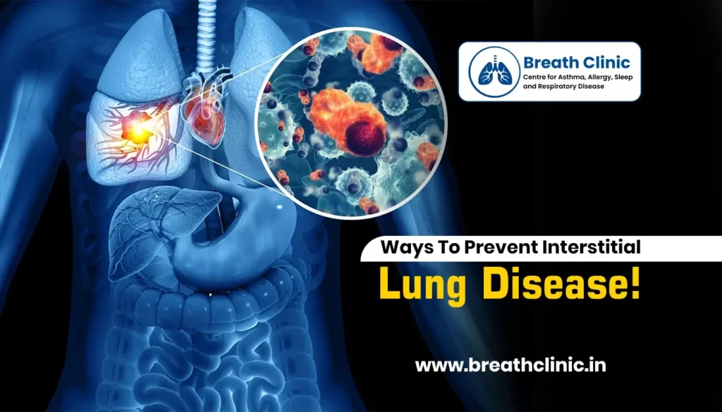 ways to prevent ILD