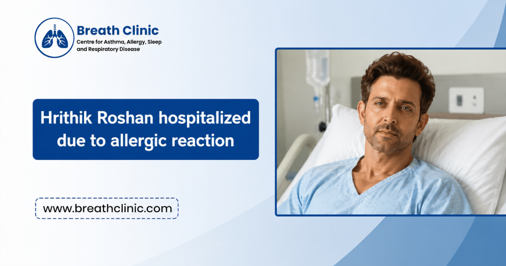 Hrithik Roshan allergic reaction