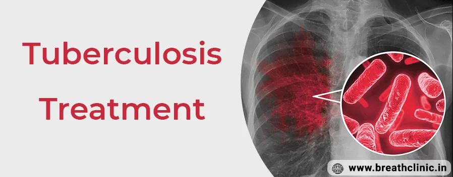 Tuberculosis Treatment in Jaipur