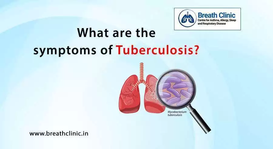 symptoms of tuberculosis
