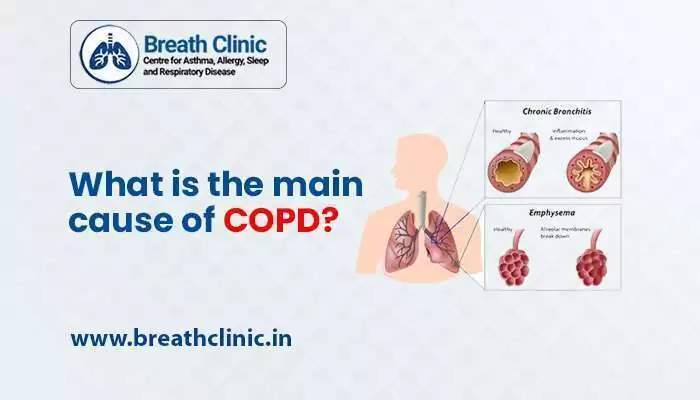 COPD