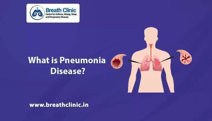 Pneumonia Disease