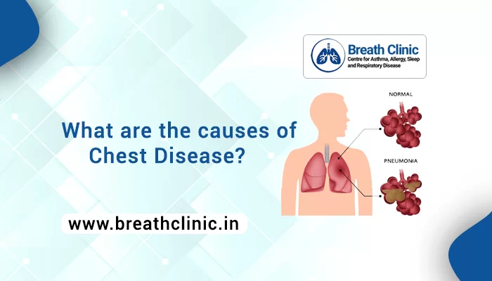 causes of Chest Disease