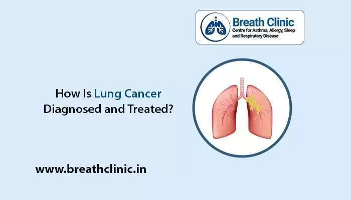 Lung cancer