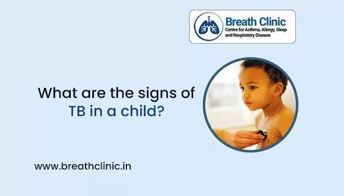 Signs of TB in a Child
