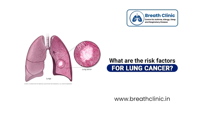 risk factors for lung cancer