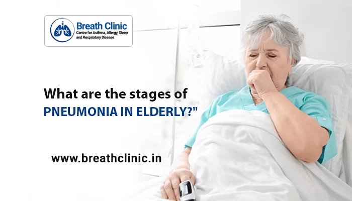 Stages of Pneumonia in Elderly
