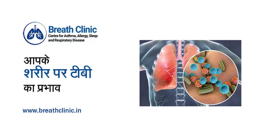 आपके शरीर पर टीबी का प्रभाव